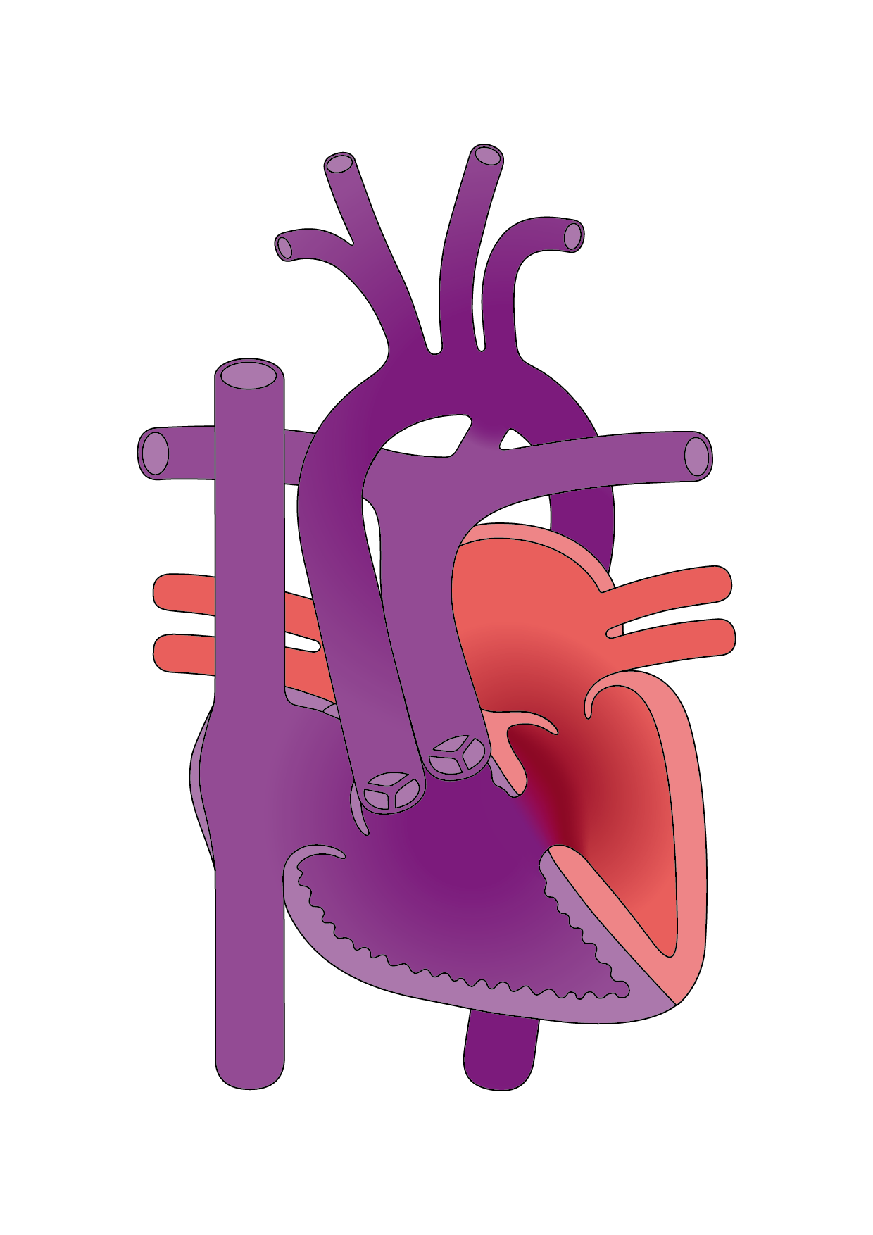 Congenital Heart Disease Diagrams – Christine Keller Graf